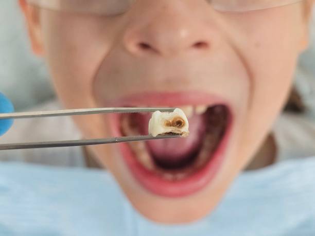 Best Emergency Denture Repair in Oakwood, IL