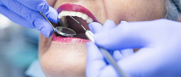 Best Dental Abscess Treatment in Oakwood, IL